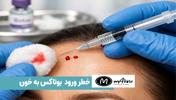 اگر بوتاکس اشتباهاً وارد خون شود چه می‌شود؟
